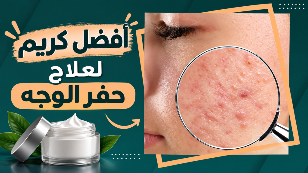 افضل كريم لعلاج حفر الوجه